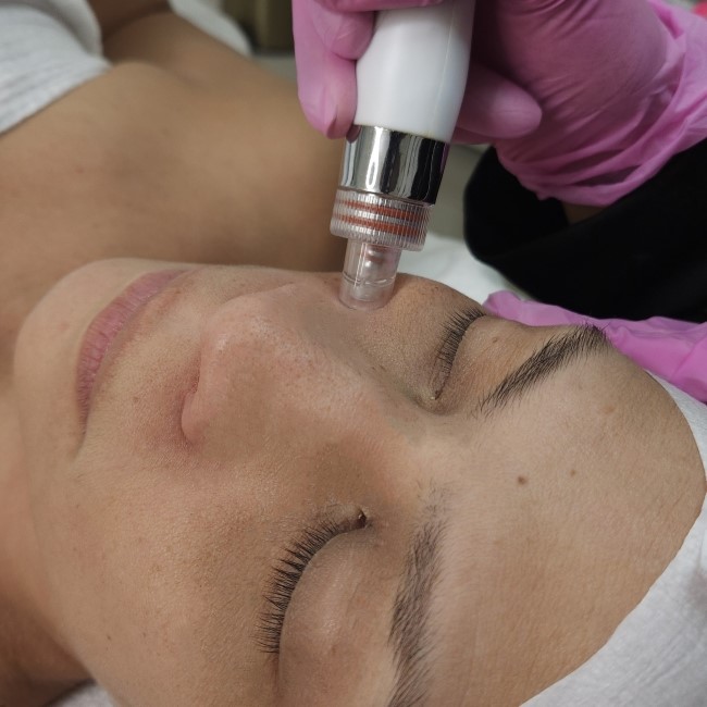 Hydrafacial